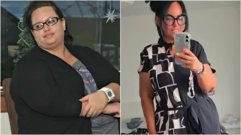 They Dropped Weight Using Shots – Followed By the Sagging Skin